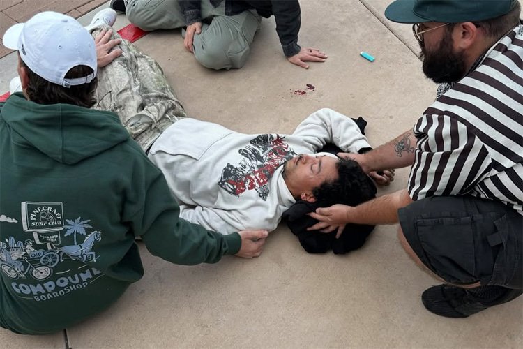 Nyjah Huston: the Olympic skateboarder fractured skull and a fractured eye socket after a hard slam while skating in Arizona