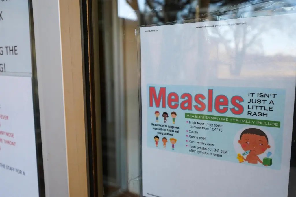 Measles Exposure Alert: LAX and Disneyland Health Risk Health officials warn of possible measles exposure at LAX, Disneyland – Orange County Register