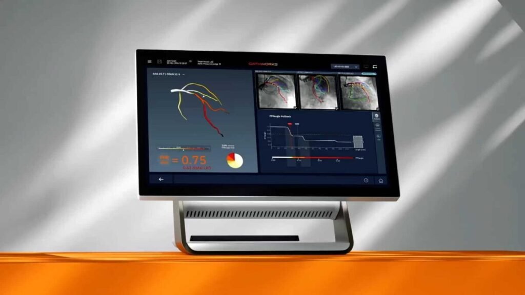 Medtronic to Buy CathWorks for $585M